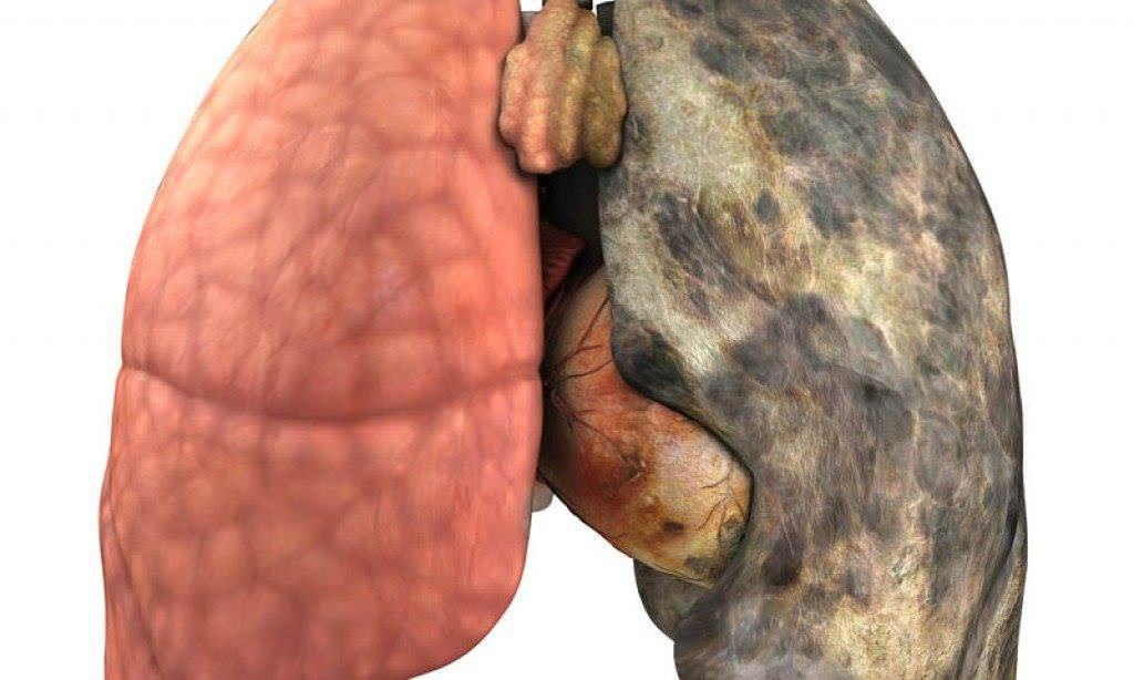 Курение негативно отражается на дыхательной системе