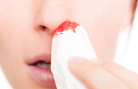 Из носа сгустки крови: причины. почему образуются? методы терапии