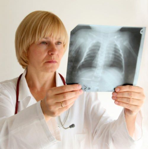 Рентген-снимок легких