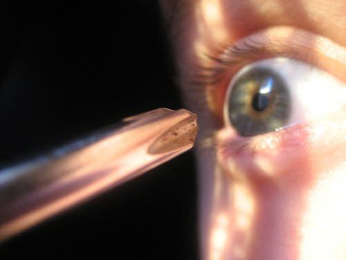 Айхмофобия — страх ножей и других острых предметов