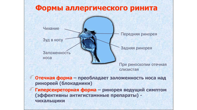 Аллергия на пыль, клеща домашней пыли: симптомы, лечение, особенности у детей