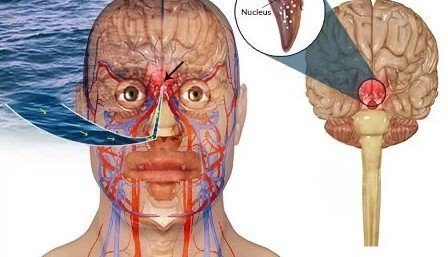 Амебный менингит, менингоэнцефалит: симптомы, первичные признаки