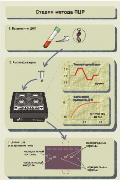 Анализ крови на пцр – что это такое, суть метода, показания к назначению, расшифровка анализа крови пцр