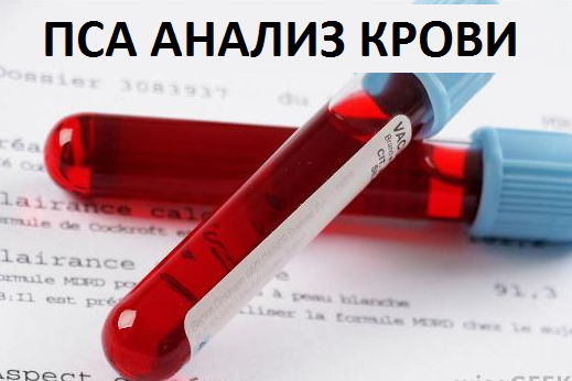 Анализ крови на пса: норма, расшифровка анализа крови на пса, общий пса в анализе крови