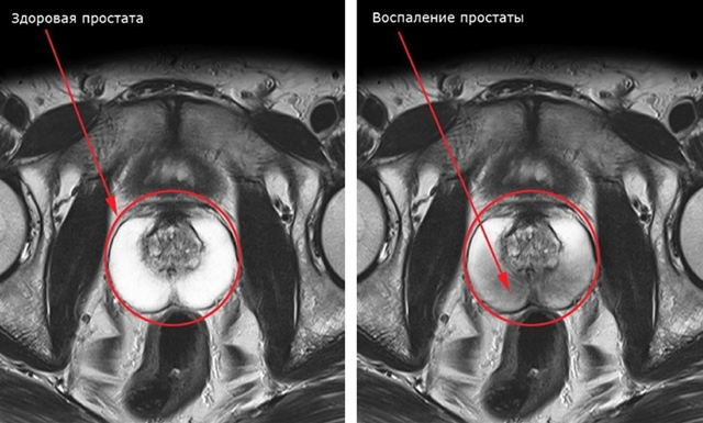 Анализ крови на пса: норма, расшифровка анализа крови на пса, общий пса в анализе крови