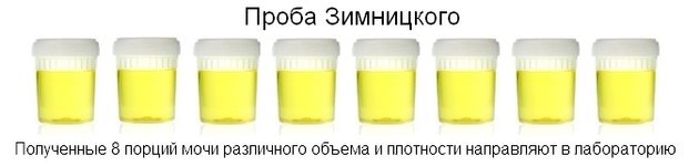 Анализ мочи по нечипоренко, проба зимницкого, проба сулковича, трехстаканная проба: расшифровка результатов.