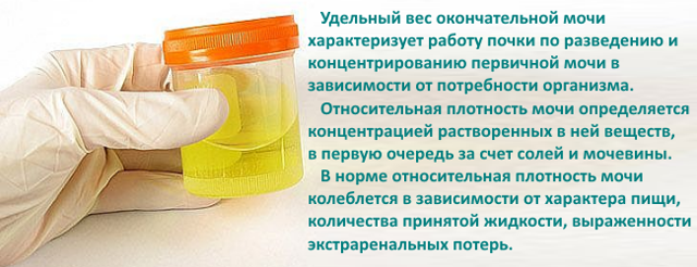 Анализы мочи: виды, расшифровка, правила подготовки и сдачи, виды изменений зменения при болезнях.