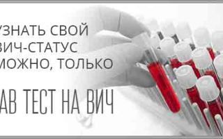 Анализы на вич: когда сдавать, какие бывают анализы на вич, когда сдавать после заражения.