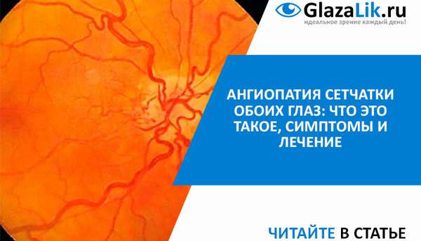 Ангиопатия сетчатки глаза — что это такое, причины, симптомы, лечение