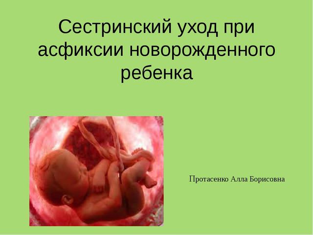 Асфиксия новорожденных: 5 механизмов развития, 3 степени тяжести