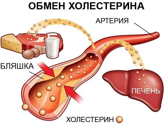 Атеросклероз: симптомы, причины, способы диагностики и профилактики, медикаментозные методы латеросклероз: симптомы, причины, способы диагностики и профилактики, медикаментозные методы лечения атеросклероза и средства народной медицины