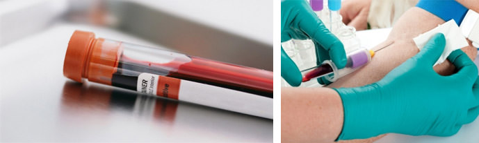 Аутогемотерапия: показания, отзыв, схема проведения