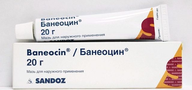 Баланопостит – симптомы баланопостита у детей и мужчин, лечение баланопостита в домашних условиях