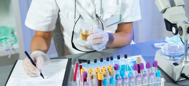 Белок в моче &mdash; что это значит, причины появления, что делать