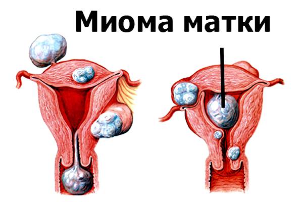 Биопрепарат стелла во время климакса: польза, инструкция, аналоги