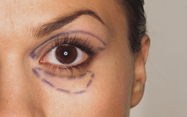 Блефаропластика в москве. цены 2019 года рейтинг клиник, как выбрать хирурга, акции, скидки, полезное с форумов