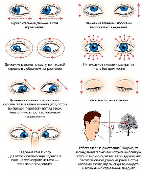Близорукость – степени, лечение, коррекция миопии, упражнения для глаз