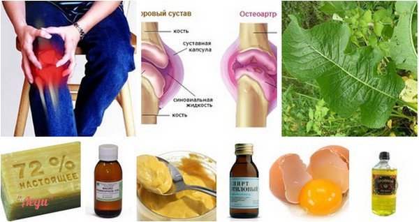 Боль в суставах — снять боль в суставах народными средствами / народная медицина