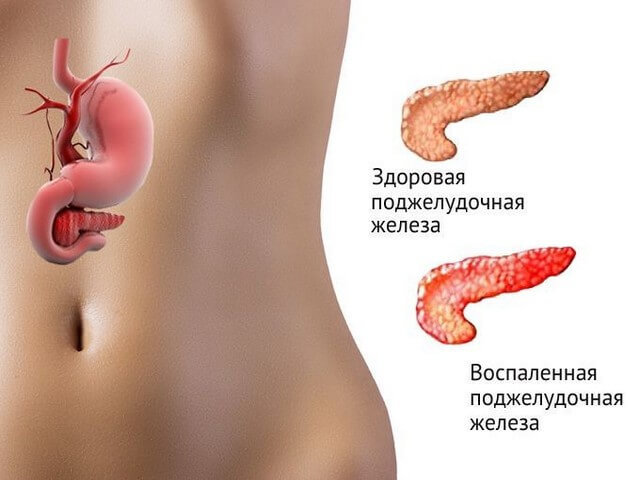Боль в верхнем отделе живота: основные причины, возможные заболевания, диагностика и принципы лечения