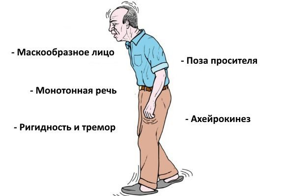 Болезнь паркинсона лечение в домашних условиях, причины возникновения