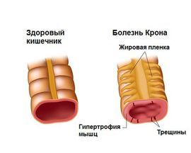 Болезненное уплотнение в животе у женщин:  возможные причины и методы диагностики 