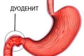 Болезненное уплотнение в животе у женщин:  возможные причины и методы диагностики 