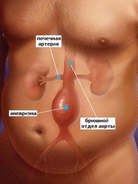 Болезненное уплотнение в животе у женщин:  возможные причины и методы диагностики 