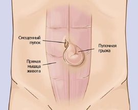 Болезненное уплотнение в животе у женщин:  возможные причины и методы диагностики 