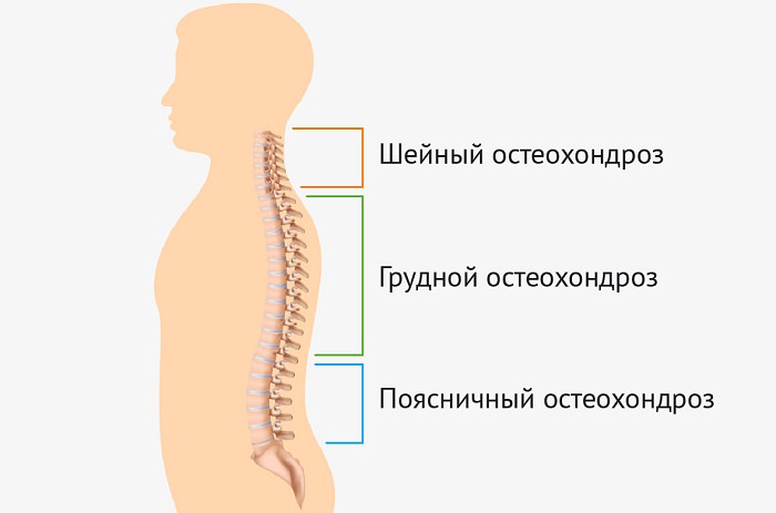 Боли в шее — основные причины их появления