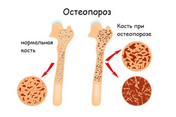 Болит поясница, когда сижу и наклоняюсь, что это может быть?