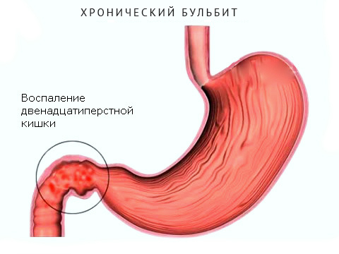 Болит в правом боку под ребрами, с чем это связано?