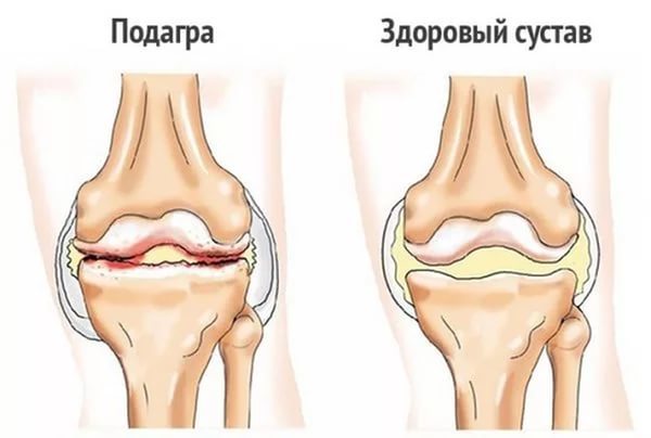 Болят пальцы рук: возможные заболевания, клиническая картина, диагностика и принципы лечения