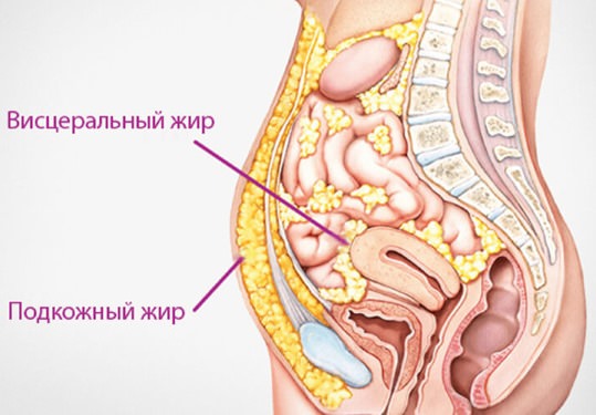 Большой живот. как убрать, причины и лечение у женщин и мужчин. косметологические процедуры, рецепты в домашних условиях