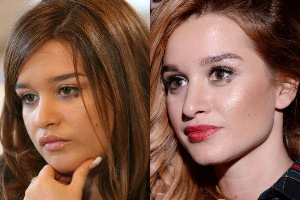 Бородина до и после пластики. фото, операции на носу, похудение ксении, биография и личная жизнь