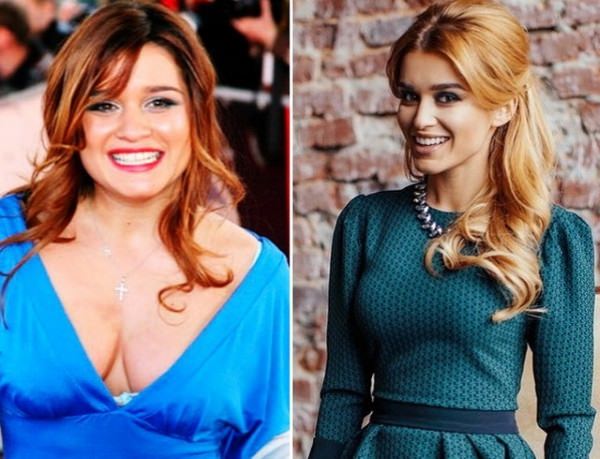 Бородина до и после пластики. фото, операции на носу, похудение ксении, биография и личная жизнь