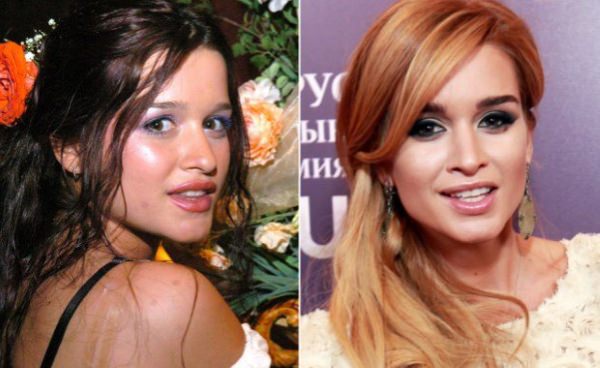 Бородина до и после пластики. фото, операции на носу, похудение ксении, биография и личная жизнь