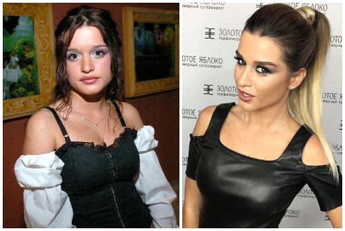 Бородина до и после пластики. фото, операции на носу, похудение ксении, биография и личная жизнь