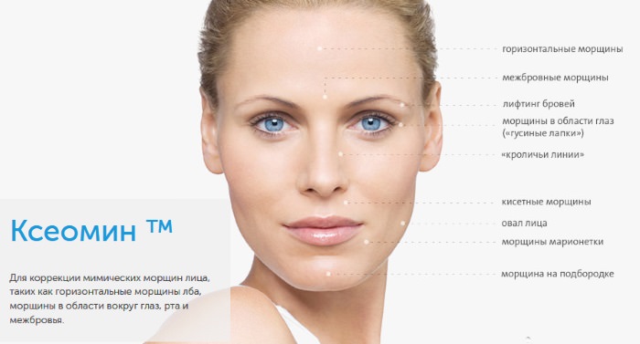 Ботулинотерапия препаратом ксеомин в неврологии, косметологии. процедуры, цены, отзывы