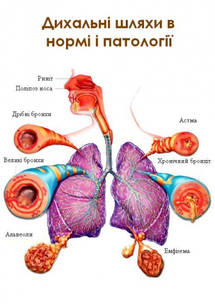 Бронхиальная астма народная медицина