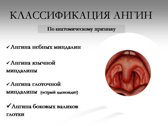 Чем лечить ангину при беременности: опасность тонзиллита в 1, 2 и 3 триместрах