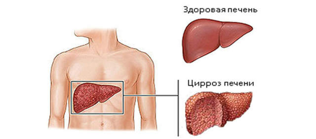 Чем помочь, если сахар больше 20 дней несколько дней?