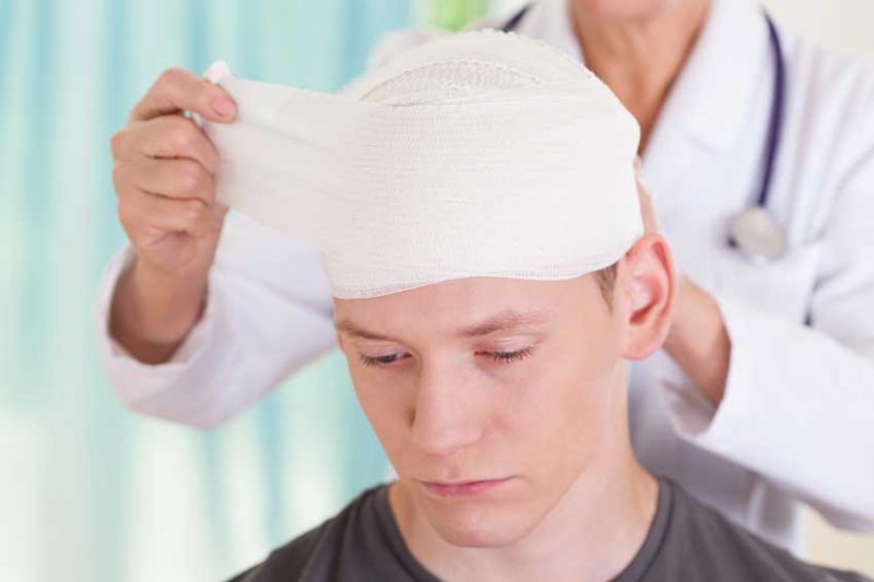 Черепно-мозговая травма — симптомы, первая помощь, последствия
