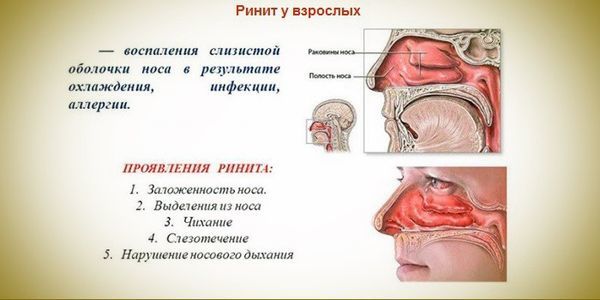 Что делать, если болит горло, температура, рвота и кашель?