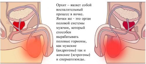 Что делать, если обнаружили уреоплазму, уреалитикум и хламидию?