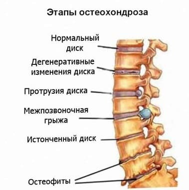 Что делать, если постоянно слышу в ухе звук пульсирующей крови?