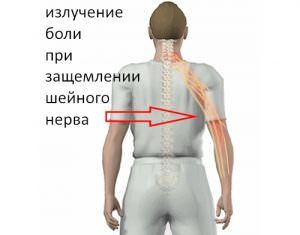 Что делать если защемило нерв спины под лопаткой, как лечить дома