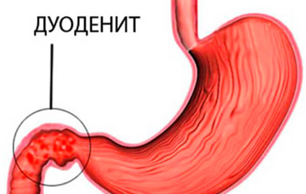 Что делать при сильной колющей боли в правом боку?