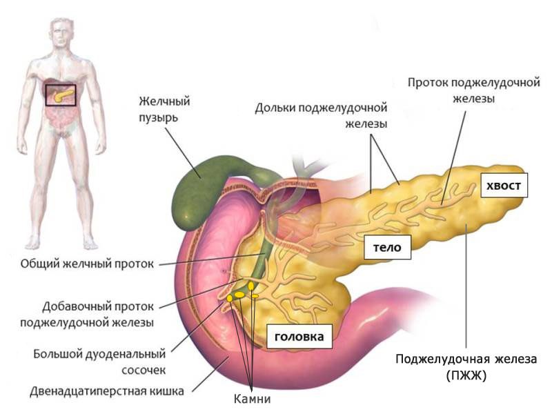 Что это за болезнь панкреатит: симптомы и лечение, диета