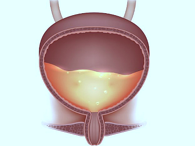 Что предпринять мужчине от частого мочеиспускания мужчине?