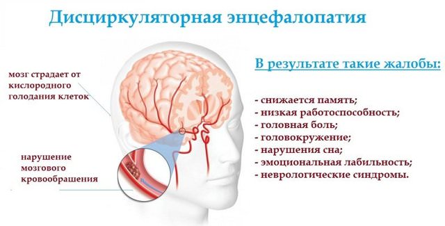 Что такое дисциркуляторная энцефалопатия 1 и 2 степени